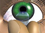 indepartarea unei lentile de contact